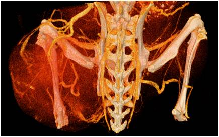 肺纖維3.jpg 肺纖維3.jpg